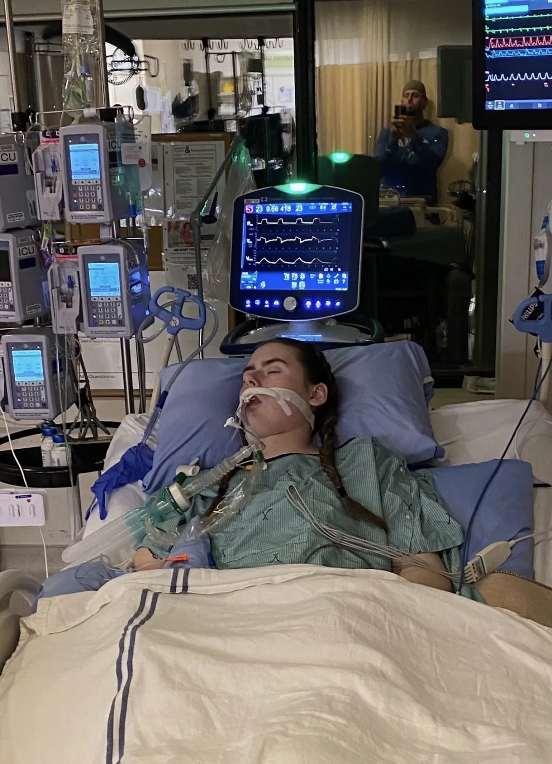 A medical archive photo of Alex Kowalski in the Intensive Care Unit (ICU) at Health Sciences North. She is lying in a hospital bed, intubated on a ventilator, and surrounded by complex medical monitoring equipment.